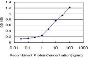 Detection limit for recombinant GST tagged ZIC1 is approximately 0. (ZIC1 Antikörper  (AA 2-95))