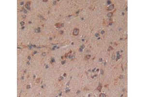 Used in DAB staining on fromalin fixed paraffin- embedded Kidney tissue (14-3-3 theta Antikörper  (AA 1-241))
