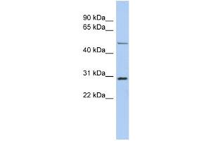 WB Suggested Anti-POU3F3 Antibody Titration:  0. (POU3F3 Antikörper  (N-Term))