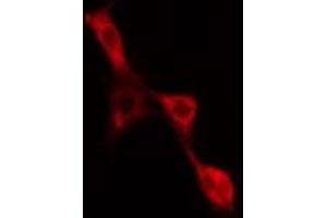 ABIN6277567 staining NIH-3T3 cells by IF/ICC. (EIF4B Antikörper  (Internal Region))