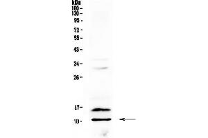 Western blot analysis of PF4 using anti-PF4 antibody . (PF4 Antikörper  (AA 30-105))