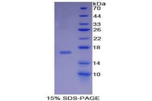 SDS-PAGE analysis of Mouse BMP15 Protein. (BMP15 Protein)