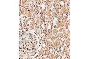 Immunohistochemistry (Paraffin-embedded Sections) (IHC (p)) image for anti-RAB1B, Member RAS Oncogene Family (RAB1B) (AA 166-194), (C-Term) antibody (ABIN657731)