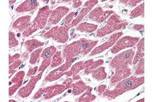 Human Heart (formalin-fixed, paraffin-embedded) stained with CPT1Aat 4 µg/ml followed by biotinylated anti-goat IgG secondary antibody, alkaline phosphatase-streptavidin and chromogen. (CPT1A Antikörper  (Internal Region))