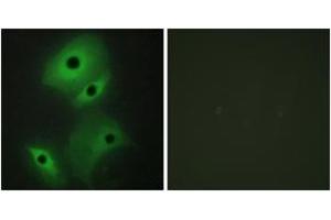 Immunofluorescence (IF) image for anti-Neuroblastoma 1, DAN Family BMP Antagonist (NBL1) (AA 131-180) antibody (ABIN2889475) (NBL1 Antikörper  (AA 131-180))