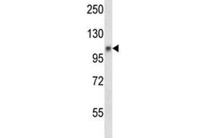 Western Blotting (WB) image for anti-Janus Kinase 1 (JAK1) (AA 120-148) antibody (ABIN3028773)