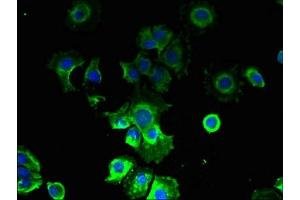 Immunofluorescent analysis of MCF-7 cells using ABIN7146656 at dilution of 1:100 and Alexa Fluor 488-congugated AffiniPure Goat Anti-Rabbit IgG(H+L) (CMTR2 Antikörper  (AA 301-600))