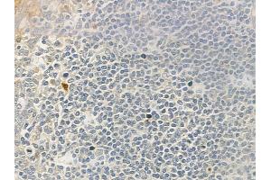 ABIN6262555 and ABIN6276764 at 1/100 staining human normal tonsil tissue by IHC-P. (IL23R Antikörper  (N-Term))