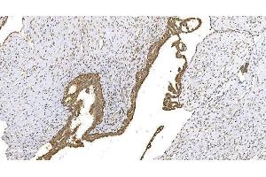 IHC analysis of WEE1 using anti-WEE1 antibody (ABIN6719614). (WEE1 Antikörper)