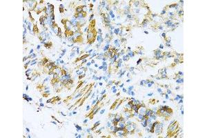 Immunohistochemistry of paraffin-embedded Mouse lung using VAMP1 Polyclonal Antibody at dilution of 1:100 (40x lens).
