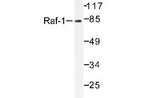 Image no. 1 for anti-V-Raf-1 Murine Leukemia Viral Oncogene Homolog 1 (RAF1) antibody (ABIN271798) (RAF1 Antikörper)