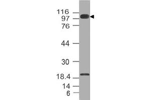 Image no. 1 for anti-Furin (Paired Basic Amino Acid Cleaving Enzyme) (FURIN) (AA 602-791) antibody (ABIN5027211) (FURIN Antikörper  (AA 602-791))