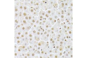 Immunohistochemistry of paraffin-embedded rat liver using CDK4 Antibody. (CDK4 Antikörper  (AA 1-303))
