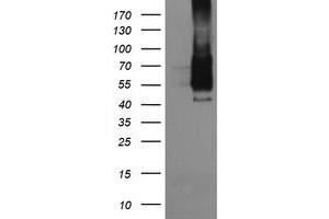 Image no. 1 for anti-Fc Fragment of IgG, High Affinity Ia, Receptor (CD64) (FCGR1A) antibody (ABIN1497349) (FCGR1A Antikörper)