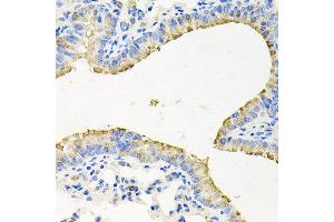 Immunohistochemistry of paraffin-embedded mouse lung using STRN3 antibody at dilution of 1:100 (x40 lens). (STRN3 Antikörper)