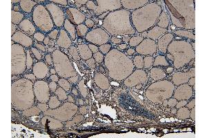Immunohistochemistry (IHC) image for anti-Ectonucleotide Pyrophosphatase/phosphodiesterase 1 (ENPP1) (C-Term) antibody (ABIN185487)