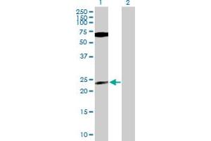 Western Blot analysis of PPP1CB expression in transfected 293T cell line by PPP1CB MaxPab polyclonal antibody.