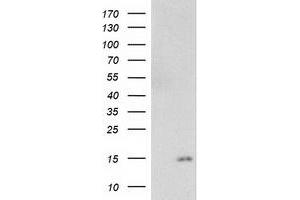 Western Blotting (WB) image for anti-NADH Dehydrogenase (Ubiquinone) 1 alpha Subcomplex, 7, 14.5kDa (NDUFA7) antibody (ABIN1499657) (NDUFA7 Antikörper)
