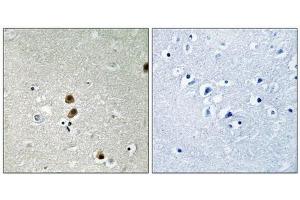 Immunohistochemical analysis of paraffin-embedded human brain tissue, using CtBP1 (Phospho-Ser422) antibody (left)or the same antibody preincubated with blocking peptide (right). (CTBP1 Antikörper  (pSer422))
