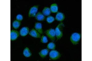 IF analysis of MLX-interacting protein/MLXIP using anti-MLX-interacting protein/MLXIP antibody (ABIN7602593). (MLXIP Antikörper  (AA 88-348))