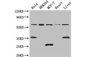 Western Blot Positive WB detected in: Hela whole cell lysate, HEK293 whole cell lysate, MCF-7 whole cell lysate, Mouse heart tissue, Mouse liver tissue All lanes: NCOA5 antibody at 3 μg/mL Secondary Goat polyclonal to rabbit IgG at 1/50000 dilution Predicted band size: 66 kDa Observed band size: 66, 35, 25 kDa (NCOA5 Antikörper  (AA 112-283))