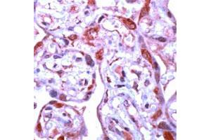 Immunohistochemical staining of human placenta stained with MMP1 polyclonal antibody  at 1 : 100 for 10 min at RT. (MMP1 Antikörper  (C-Term))