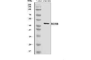 Western blot analysis of ROR beta/RORB using anti-ROR beta/RORB antibody (ABIN7600788).