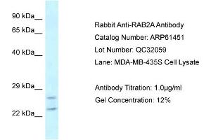 Western Blotting (WB) image for anti-RAB2A, Member RAS Oncogene Family (RAB2A) (C-Term) antibody (ABIN2774315)