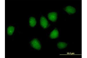 Immunofluorescence of purified MaxPab rabbit antibody to NR3C1 on HeLa cell. (Glucocorticoid Receptor Antikörper  (AA 1-777))