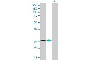 Western Blot analysis of CYB5R2 expression in transfected 293T cell line by CYB5R2 MaxPab polyclonal antibody.
