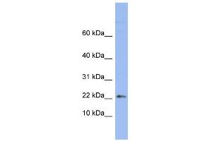 WB Suggested Anti-RPS24 Antibody Titration:  0. (RPS24 Antikörper  (Middle Region))