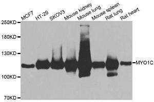 Western blot analysis of extracts of various cell lines, using MYO1C antibody. (Myosin IC Antikörper  (AA 769-1028))