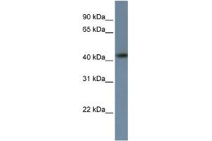 WB Suggested Anti-ZNF669 Antibody Titration:  0. (ZNF669 Antikörper  (C-Term))