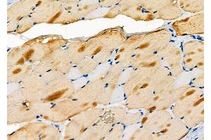 ABIN6257114 and ABIN6274151 at 1/100 staining Rat skin tissue by IHC-P. (CKM Antikörper  (N-Term))