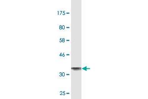 Western Blot detection against Immunogen (37. (ALPL Antikörper  (AA 91-200))