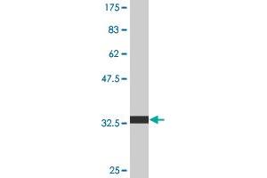 Western Blot detection against Immunogen (34. (SMARCB1 Antikörper  (AA 123-202))