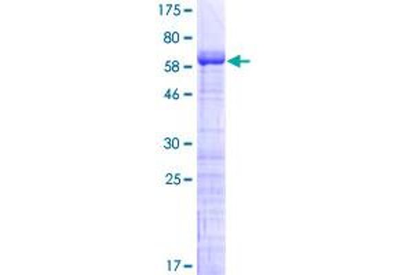 MAGEB2 Protein (AA 1-319) (GST tag)