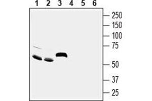 Western blot analysis of rat brain (lanes 1 and 4), mouse brain (lanes 2 and 5) and rat small intestine (lanes 3 and 6) lysates: - 1-3. (ACCN5 Antikörper  (Extracellular))