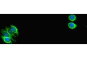 Immunofluorescent analysis of HepG2 cells using ABIN7169664 at dilution of 1:100 and Alexa Fluor 488-congugated AffiniPure Goat Anti-Rabbit IgG(H+L) (STAT1 Antikörper  (AA 63-196))