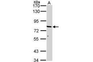Image no. 2 for anti-ATP-Binding Cassette, Sub-Family D (ALD), Member 2 (Abcd2) (AA 338-558) antibody (ABIN467567) (Abcd2 Antikörper  (AA 338-558))