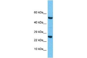 Western Blotting (WB) image for anti-Related RAS Viral (R-Ras) Oncogene Homolog 2 (RRAS2) (C-Term) antibody (ABIN2785767) (RRAS2 Antikörper  (C-Term))