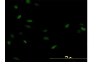 Immunofluorescence of monoclonal antibody to POLA2 on HeLa cell. (POLA2 Antikörper  (AA 1-598))