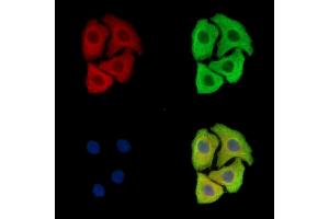 ABIN7097063 and ABIN7101130 staining Hela cells by IF/ICC. (FAM161B Antikörper)