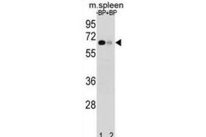 Western Blotting (WB) image for anti-Ankyrin Repeat and SOCS Box-Containing 3 (ASB3) antibody (ABIN2998967) (ASB3 Antikörper)