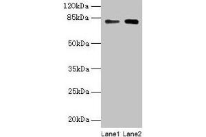 Western blot All lanes: MASP1 antibody at 6 μg/mL Lane 1: Hela whole cell lysate Lane 2: U251 whole cell lysate Secondary Goat polyclonal to rabbit IgG at 1/10000 dilution Predicted band size: 80, 82, 44, 69 kDa Observed band size: 80 kDa (MASP1 Antikörper  (AA 20-699))