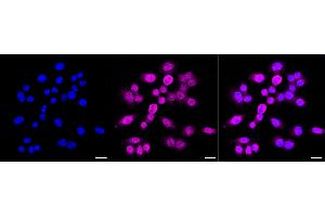 Immunocytochemical staining of HepG2 cells with Eukaryotic translation elongation factor 2 antibody (ABIN7798502), 1:1,000). (Rekombinanter EEF2 Antikörper)