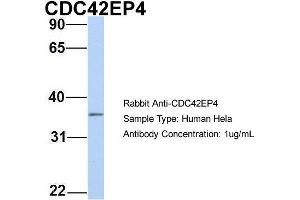 Host: Rabbit Target Name: CDC42EP4 Sample Type: Hela Antibody Dilution: 1.