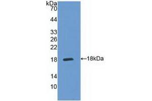 Western blot analysis of recombinant Human IL5Ra. (IL5RA Antikörper  (AA 42-182))