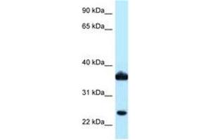 Image no. 1 for anti-Aldo-Keto Reductase Family 1, Member C3 (3-alpha Hydroxysteroid Dehydrogenase, Type II) (AKR1C3) (AA 97-146) antibody (ABIN6747883) (AKR1C3 Antikörper  (AA 97-146))