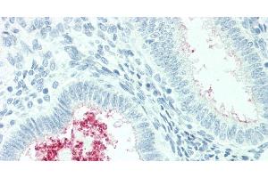 Immunohistochemistry of paraffin-embedded Human Uterus tissue using SLC34A2 Polyclonal Antibody at dilution of 1:60. (SLC34A2 Antikörper)